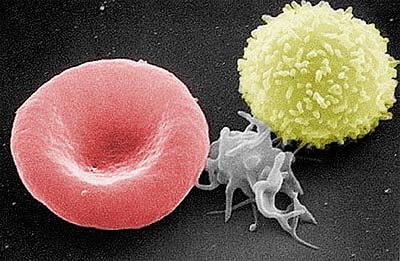 Blutzellen: Leukozyt, Erythrozyt, Thrombozyt