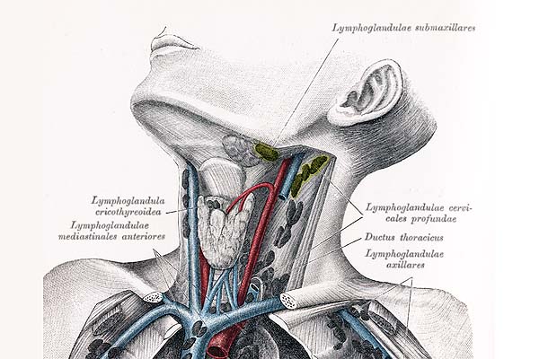 Hals geschwollenen lymphknoten am Schwellung am